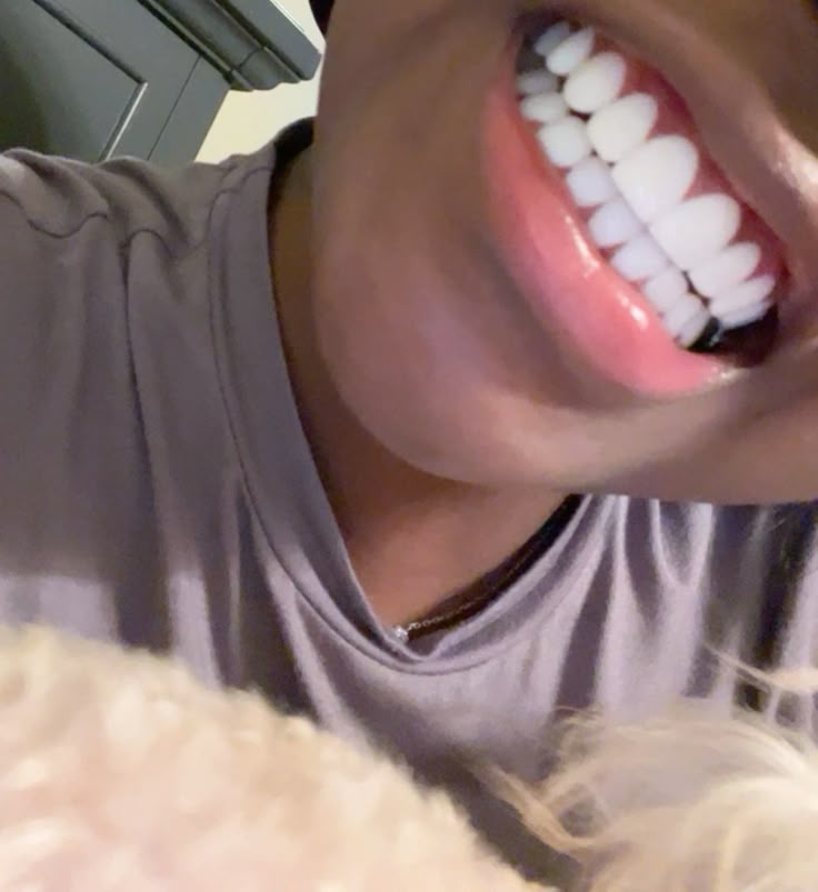 Clareador Dental 5 dias