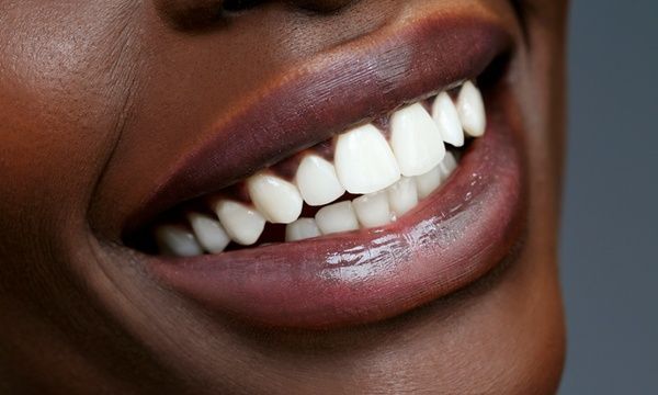 Clareador Dental 5 dias