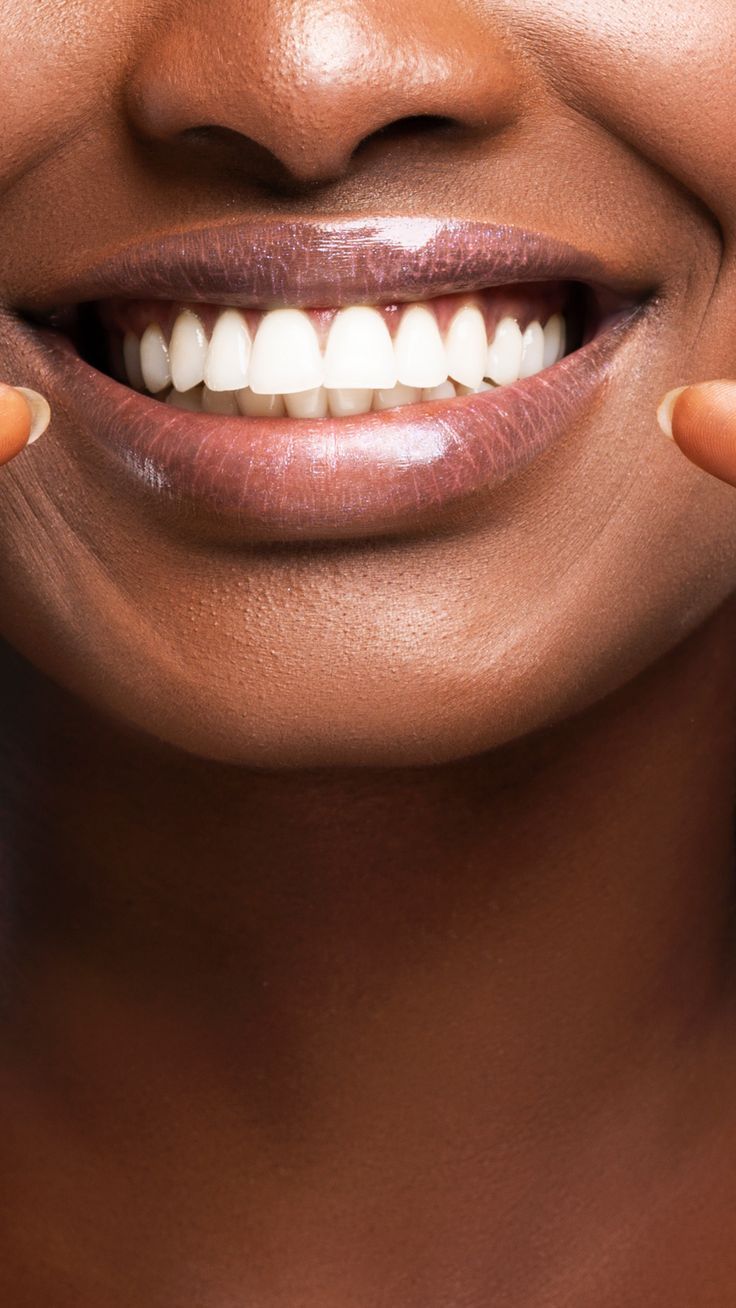 Clareador Dental 5 dias