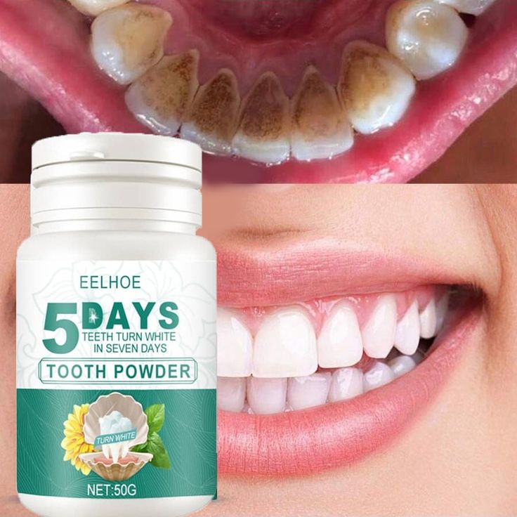 Clareador Dental 5 dias