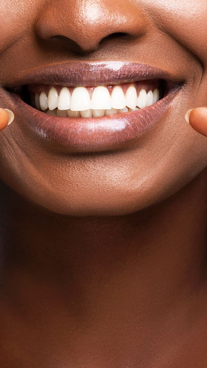 Clareador Dental 5 dias